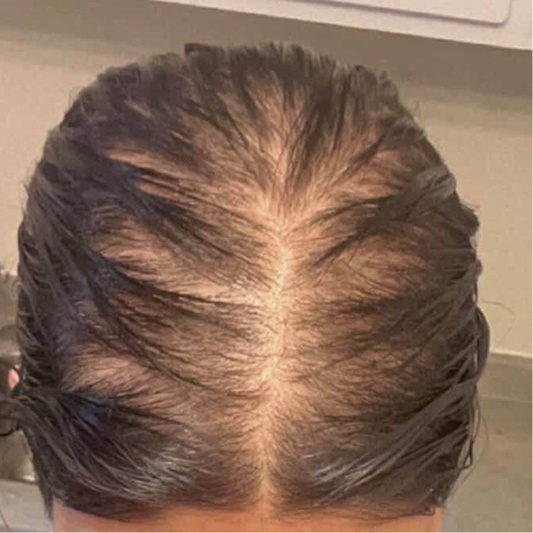 Before: customer