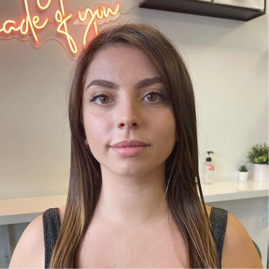 Before: customer