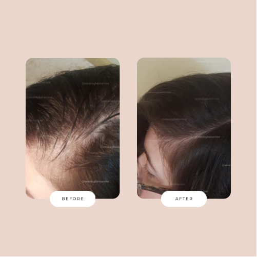 Before & After – Amazing Hair Saviour
