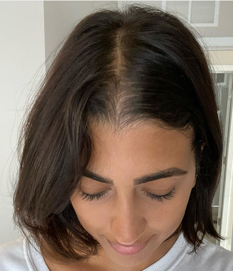 After: customer, 11 months