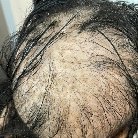 Customer hair before using Amazing Hair Saviour